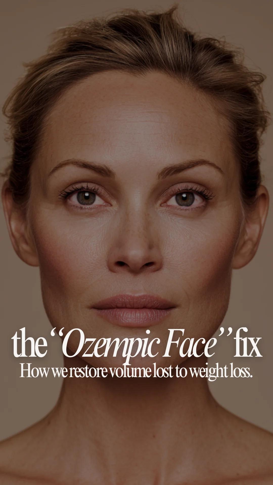 Injector template — restoring volume lost to weight loss