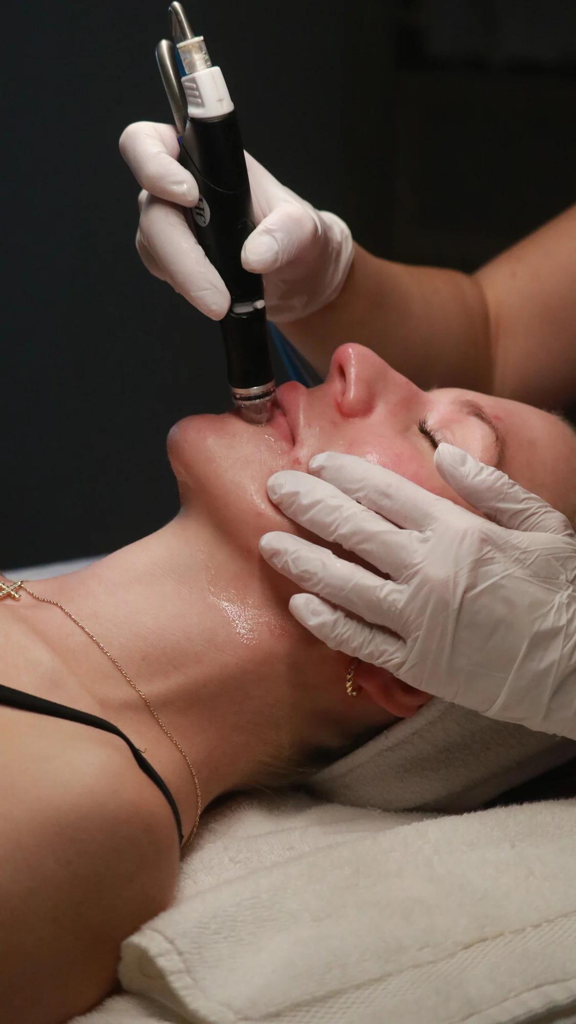 Stock photo — hydrafacial treatment in progress